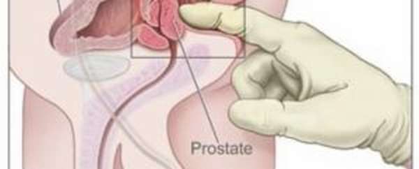 Мази для лечения простатита, мазь для массажа простаты как называются