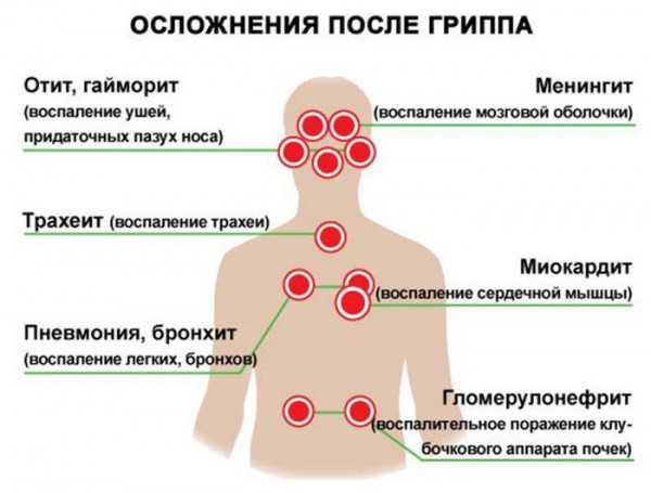 Тошнота после гриппа: остаточное явление или симптом осложнения