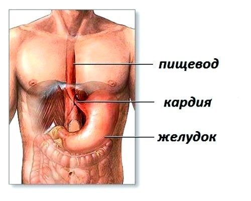 Ахалазия кардии - причины, симптомы, диагностика и лечение