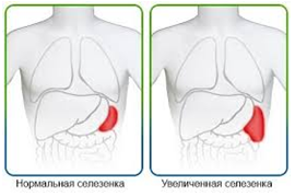 Боли в животе слева: причины и лечение боль левой части живота