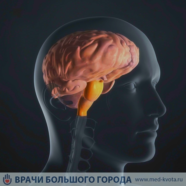 Глиома ствола мозга. последствия, фото и прогноз