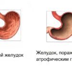 Гастрин что это такое и за что отвечает этот гормон