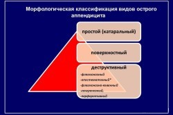 Может ли быть понос при аппендиците и как его лечить