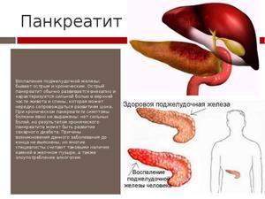 Панкреатит у детей: причины, первые признаки и лечение