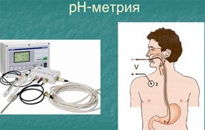 PH-метрия желудка: показания, виды, как делают