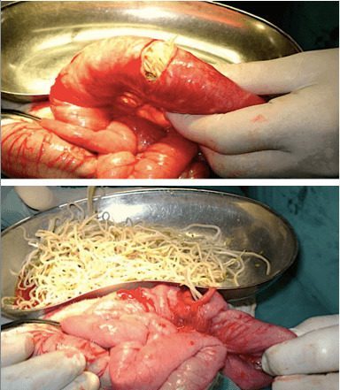 Паразиты в организме человека: фото, лечение