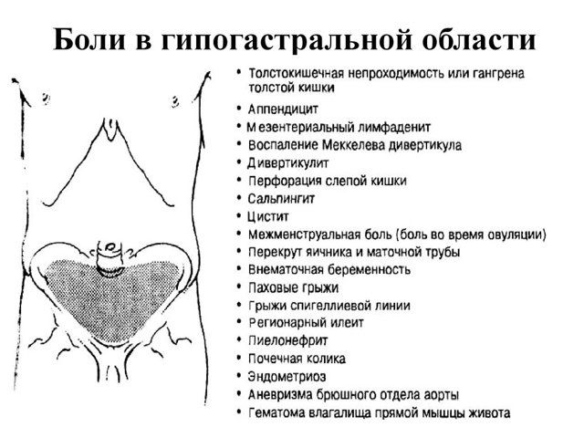 Печет внизу живота у женщин причины