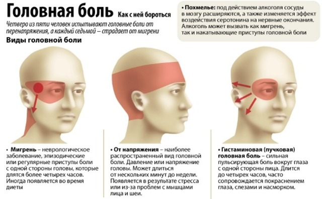 Таблетки от сильной головной боли: перечень самых эффективных