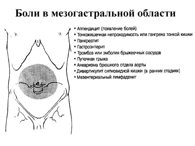 Печет внизу живота у женщин причины