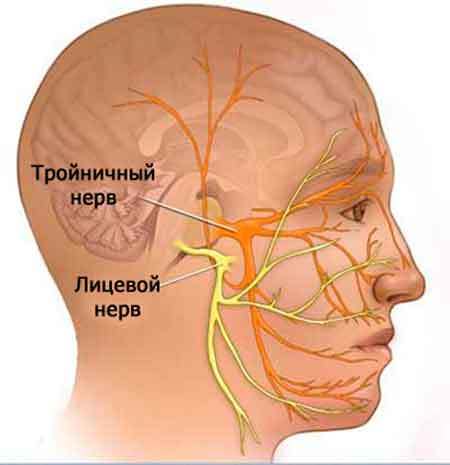 Воспаление лицевого нерва: симптомы и лечение в домашних условиях