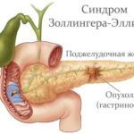 Гастрин что это такое и за что отвечает этот гормон