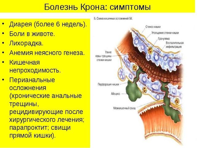 Болит низ живота справа у женщины, что это может быть, как лечить, если ноет, отдает в ногу, причины