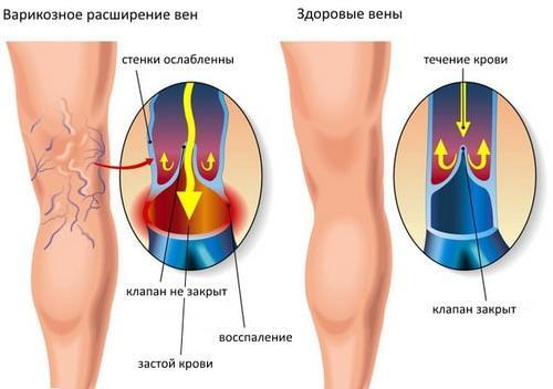 Почему чешутся ноги ниже колен: причины у женщин и мужчин, чем лечить