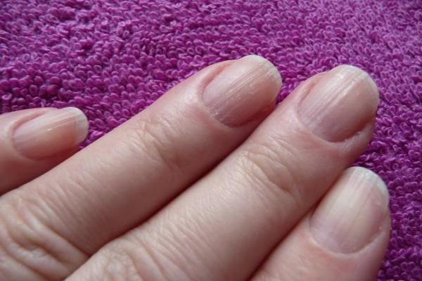Волнистые ногти на руках причины лечение
