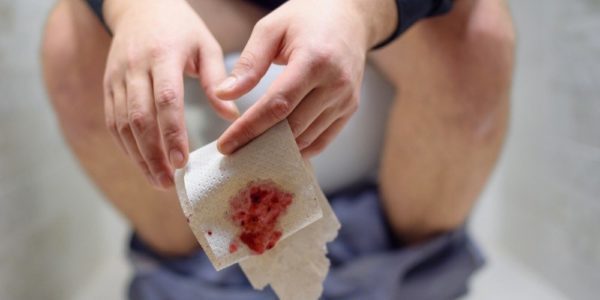 Кровь в кале у взрослого мужчины - основные причины, лечение