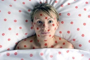 Красные пятна на лице - почему появляются и как избавиться в домашних условиях