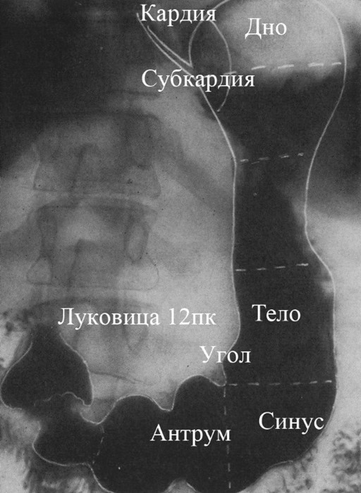 Рентген желудка с барием: что показывает, подготовка, последствия