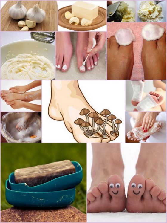 Дегтярное мыло от грибка ногтей на ногах - рецепты и отзывы
