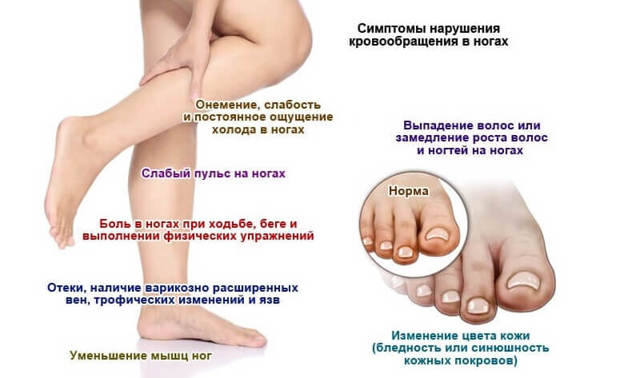 Немеет левая нога: причины и лечение недуга