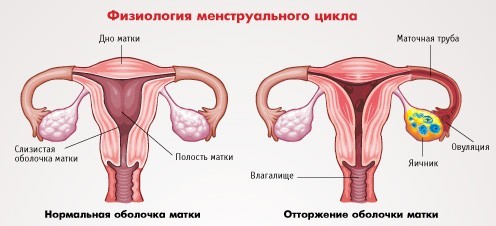 Менструация после менструации: причины повторных месячных