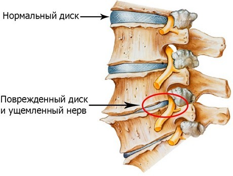 Боль в левом подреберье, ноющая, острая, тупая, колющая, тянущая боль в левом боку под ребрами сбоку, спереди, сзади – причины, лечение
