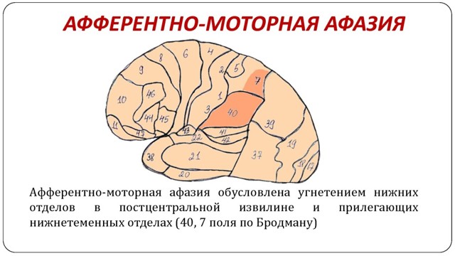 Ишемический инсульт головного мозга: лечение, восстановление и возможные последствия