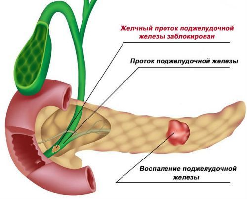 Размеры поджелудочной железы в норме