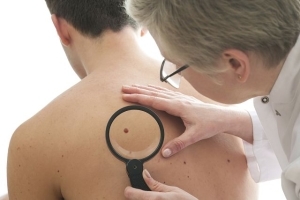 Прыщи на спине у мужчин - причины, лечение, фото, почему появляются