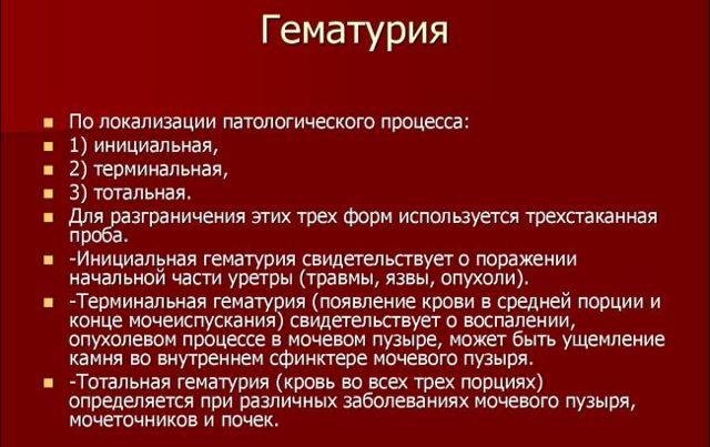 Выделения при цистите у женщин