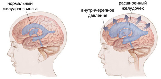 Боль за ухом слева: причины возникновения головной, в шее и затылке справа