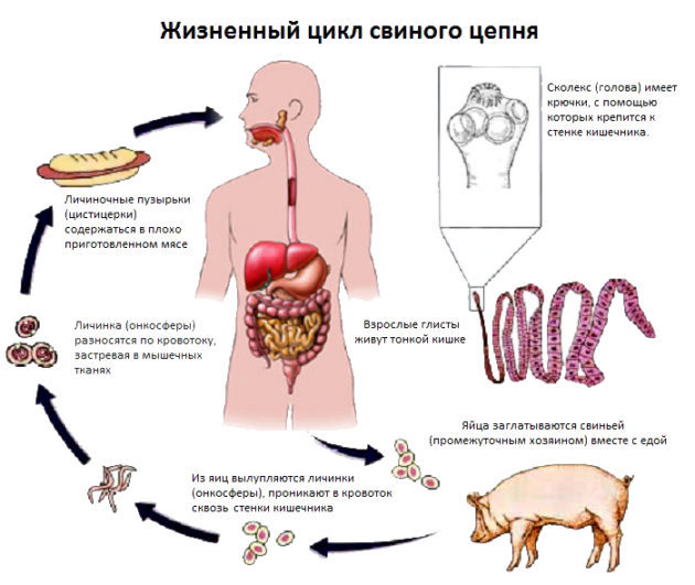 Цепень у человека бычий и свиной - симптомы и лечение