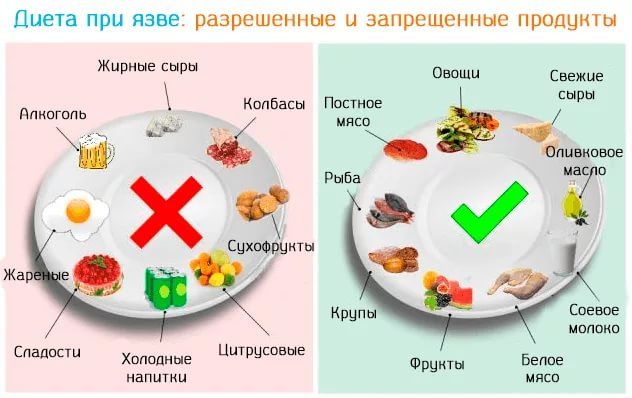 Диета при язве двенадцатиперстной кишки - что можно есть, рецепты