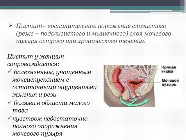 Боли внизу живота при переохлаждении: причины, симптомы и методы лечения